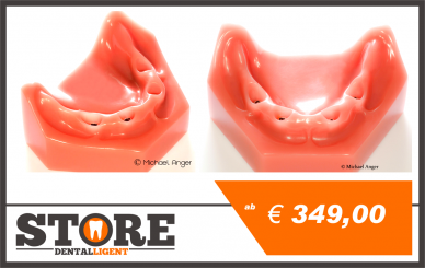 Lower DEMO-Jaw with 4 Implants without abutments 