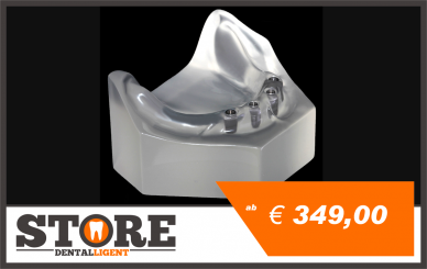 UK Modell mit 4 Implantaten in klarem Acryl ohne Abutments 
