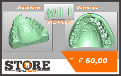 OK-Model D1-STL-Files for self-print 