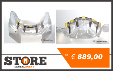 Lower Jaw clear with 4 Implants and screwed Bar NP 