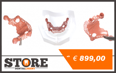 Modell aus klarem Acryl mit rosa PEEK-Sekundärteleskopen und PEEK-Modellguss 