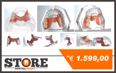 Modell aus klarem Acryl mit PEEK-Modellguss für Geschiebe-Demonstration. Halbseitig fertiggestellt mit Konfektionszähnen. 