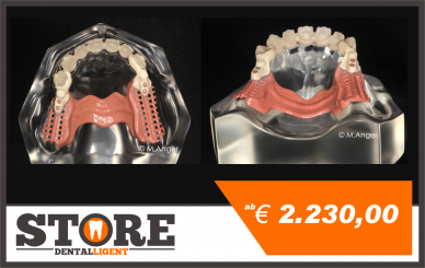 Acryl-Modell mit Zirkon-Front 14-23, gefrästen Lagern und Geschieben sowie Schubverteilern in zahnfarbenem PEEK und Modellguss in rosa PEEK verklebt zum selbst Verblenden und Fertigstellen. 