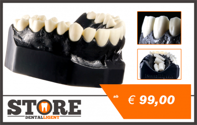 DEMO Modell PS1 - OK mit 14 anatomischen, herausnehmbaren Zähnen 