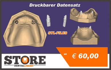 OK-Model T1-STL-Files for self-print 