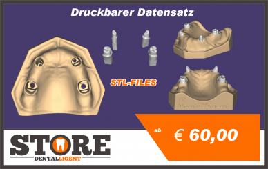 OK-Model T2-STL-Files for self-print 