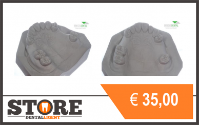 Upper-jaw-model for Partial Framework with replacement 14-15 &25-26 in Superhardplaster 