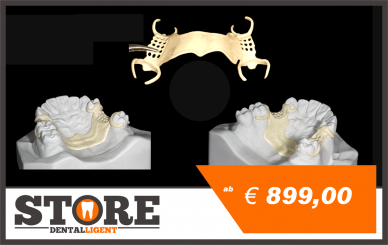 Plaster model with toothcolored PEEK Partial Framework and clasps at 16,13,24,27 