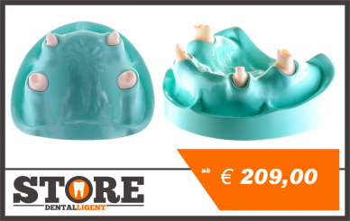 Demo-Modell aus gegossenem Acryl mit herausnehmbaren Stümpfen 13,16,23,26 