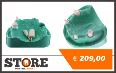 Demo-Modell aus gegossenem Acryl mit herausnehmbaren Stümpfen 13,16,23,26 