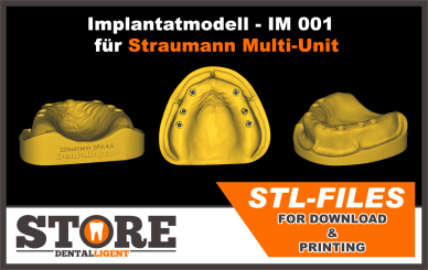 STL-Files - IM 001 Implantatmodell zum selbst Drucken  für Straumann Multi-Unit   