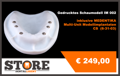IM 002 Implantatmodell fertig gedruckt  inklusive MEDENTIKA Multi-Unit Laborimplantaten 