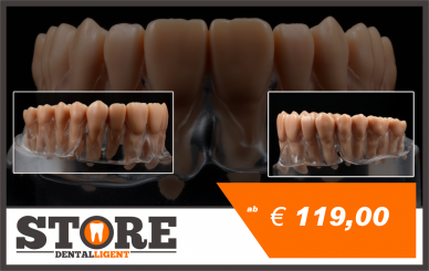 upper jaw model with root teeth in a clear acrylic base 