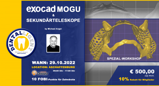 29.10.2022 - Exocad-Modellguss & Sekundärteleskope - SPEZIAL-WORKSHOP 