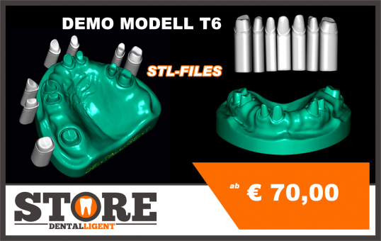 DEMO OK - Modell T6 als STL-FILE zum selber drucken, mit festsitzenden Stümpfen & separaten Arbeitsstümpfen 