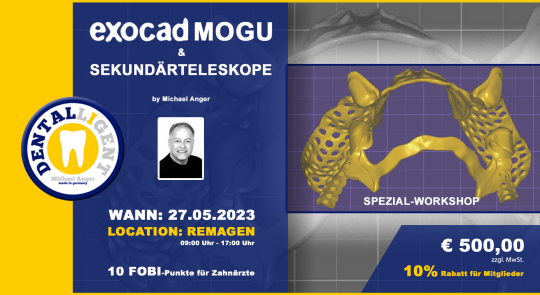 27.05.2023 - Exocad-Modellguss & Sekundärteleskope - SPEZIAL-WORKSHOP 