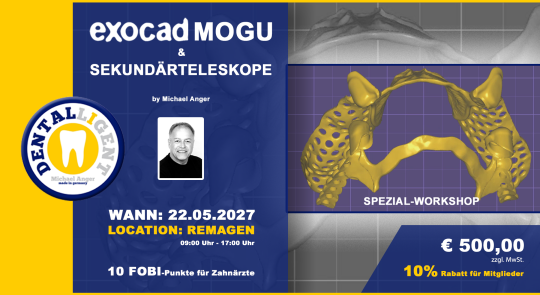 22.05.2027 - EXOCAD Modellguss & Sekundärteleskope - aktiv Workshop 