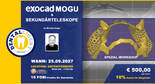 25.09.2027 - EXOCAD Modellguss & Sekundärteleskope in Aschaffenburg - aktiv Workshop 