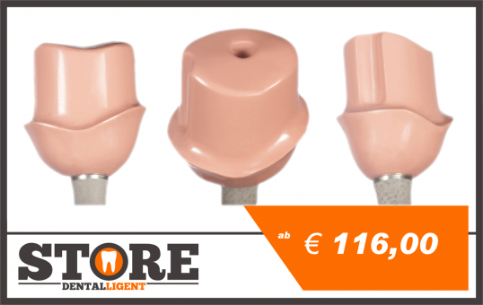 PINK PEEK telescopic-abutment with 0 ° -angled milling, included adhesive, base material and processing. 