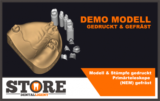 Demo Modell - Modell & Stümpfe gedruckt und Primärteleskope (NEM) gefräst 