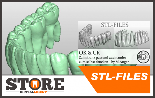 STL-FILES STL OK & UK Zahnkranz passend zueinander zum selbst drucken 
